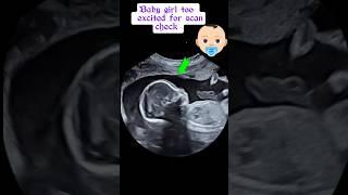 Baby girl  too excited for scan check | ultrasound #shorts #baby #pregnancy