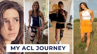 How I came back stronger after ACL surgery | Volleyball player shares emotional ACL story