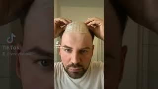 How to install thin skin base Toupee by yourself 