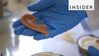 How Prosthetic Eyes And Ears Are Made