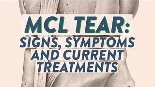 MCL tear: Signs, symptoms and current treatments