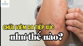 Chữa viêm da tiếp xúc như thế nào? BS Nguyễn Thị Thu Trang, BV  Vinmec Central Park