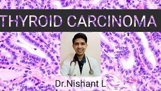 THYROID CARCINOMA | The White Army Webinar