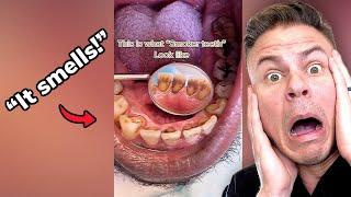 What Smoking Does To Your Teeth! Orthodontist Reacts