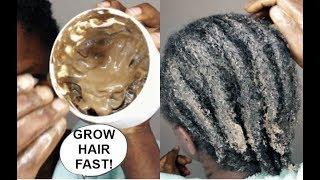 THIS CHANGED MY HAIR FROM 0 TO 100 -GROW HAIR Long, Thick & Healthy FAST!