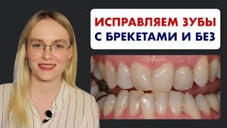 Как исправить КРИВЫЕ ЗУБЫ и почему у многих ЗУБЫ неровные