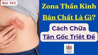 Zona Thần Kinh (Bệnh Giời Leo) Bản Chất Là Gì? Cách Điều Trị Tận Gốc Tránh Biến Chứng Nguy Hiểm