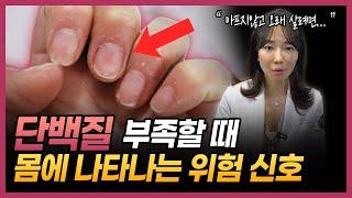 아프지않고 오래 살려면 걷기 대신 이렇게만 하세요 | 단백질이 부족할 때 몸에서 보내는 신호 | 노화의 원인, 근감소증 예방