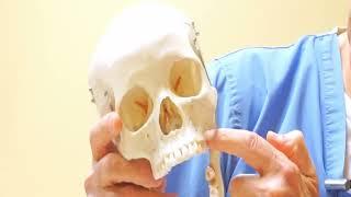 Meet Dr. Hashemian: Pterygoid implant info & placement demo