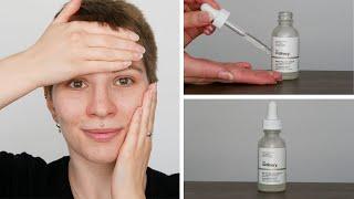 How to use The Ordinary Niacinamide 10% + Zinc 1% | Full Demonstration