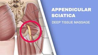 Sciatic Pain - Deep Tissue Massage for Appendicular Sciatica