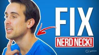 How To Fix "Nerd Neck" | Rounded Shoulders (3-STEP FIX!)