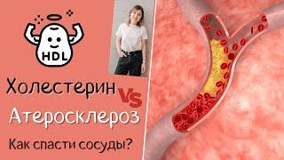 Холестерин & Атеросклероз. Как спасти сосуды? На какие цифры в анализах обращать внимание.