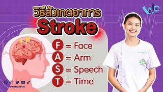 วิธีสังเกตอาการ Stroke (เส้นเลือดในสมองแตก) โดยใช้หลัก F.A.S.T.  | We Mahidol