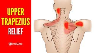 How to INSTANTLY Fix Upper Trapezius Pain