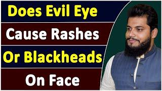 Does Evil Eye Cause Rashes or Blackheads on Human Face | Treatment With Quran | Hafiz Salman | TWQ