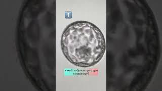 Какой из эмбрионов пригоден к переносу (ответ в описании)