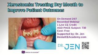 FREE DENTAL CE WEBINAR. XEROSTOMIA: Treating Dry Mouth Improve Patient Outcomes. DentalCEAcademy.com