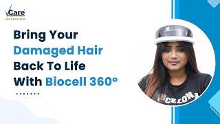 A Stem-Cell Based Therapy To Revive Damaged Hair | Biocell 360°| VCare Hair and Skin Clinics