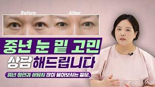 닥터혜자 피셜  중년 눈밑성형 수술 고객의 공통점!