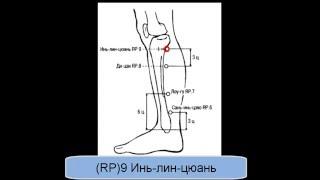 RP9 Инь-лин-цюань