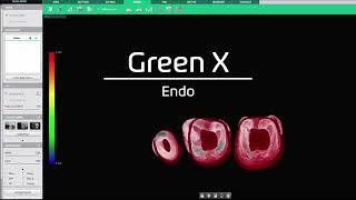 Vatech's Green X - Ideal Endo CBCT