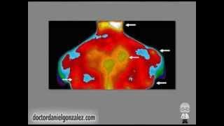 Fibromialgia - ¿Cómo se Diagnostica?