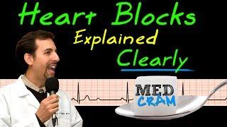 Heart Blocks on EKG / ECG Explained Clearly (MedCram EKG / ECG Course)