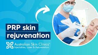 PRP Skin Rejuvenation Treatment | Australian Skin Clinics