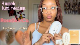 summer chronicles #6: how to get smooth skin ft RoseSkinCo Lumi