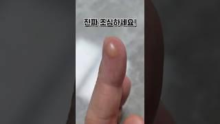 ️탕후루 만들때 조심! #탕후루 #탕후루만들기 #요리