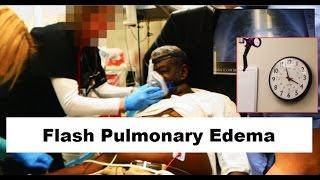 Flash Pulmonary Edema Emergency