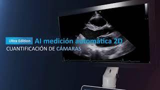 AI Mediación Automática 2D | Vivid Ultra Edition | Ultrasonido Cardiológico | GE Healthcare