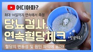 당뇨검사방법, 연속혈당체크란?(+보험적용)