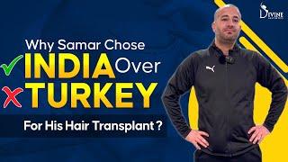 Why Samar Chose India Over Turkey for His Hair Transplant