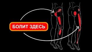 Musculus gluteus minimus: anatomy, functions, trigger points and exercises