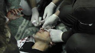 Have we forgotten Mohamed Mahmoud?  هل نسينا محمد محمود؟