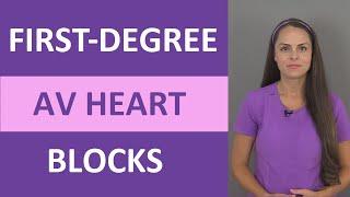 First-Degree AV Heart Block Nursing NCLEX ACLS ECG/EKG Prolonged PR Interval