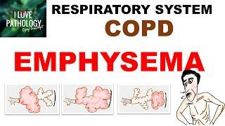 Chronic Obstructive Pulmonary Disease Part 1: Emphysema- Pathology