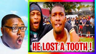 He Lost His Tooth $10K! - Deestorying | jeyevory Reacts