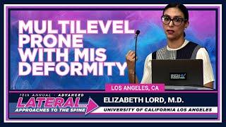 Multilevel Prone with MIS Deformity - Elizabeth Lord, M.D.