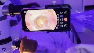 Gulani Vision Institute: Eye Surgery SPA with New 4K System to teach Gulani Techniques worldwide