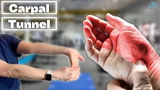 The BEST Treatments For Carpal Tunnel Syndrome!