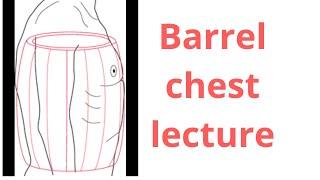 Barrel chest #chestcondition#respiratorydisease