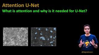 225 - Attention U-net. What is attention and why is it needed for U-Net?