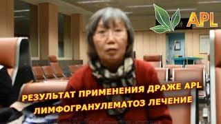 ► APLGO  Лимфогранулематоз - результат применения драже APL!