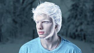 He's The World's Most Famous Albino