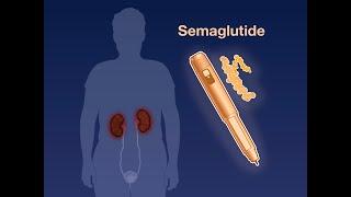 Semaglutide, Chronic Kidney Disease, and Diabetes | NEJM