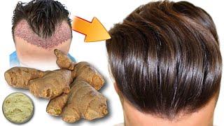 रोजाना बालोंमे कच्चे अदरक का रस लगाने से क्या होगा, Grow Hair Super Fast