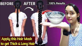 Secret!  लम्बे, मोटे, घने बाल सिर्फ 15 दिनों में || Long & Thicker Hair